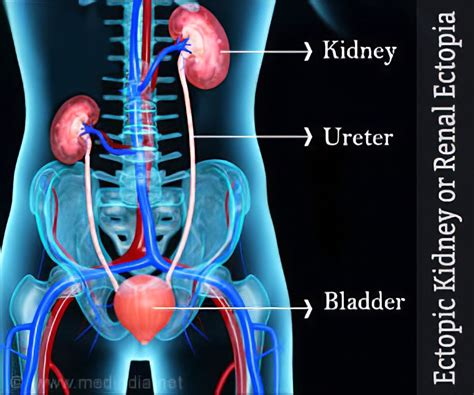 Kidney And Renal Pelvis Anatomy