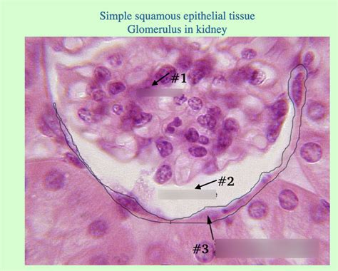 glomerulus kidney under microscope Diagram | Quizlet