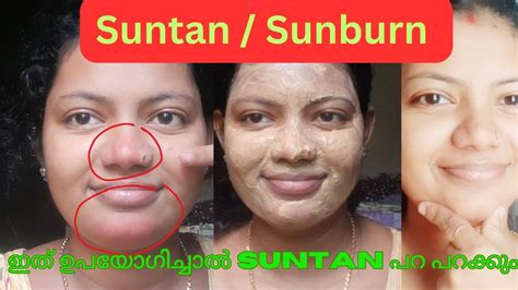 മുഖത്തെ SUNTAN മാറ്റി മുഖം നല്ല സോഫ്റ്റ് ആൻഡ് ക്ലീൻ ആക്കാൻ ഇത് രണ്ടു ...