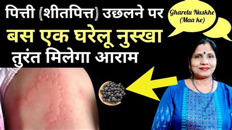 पित्ती शीतपित्त उछलने पर बस एक घरेलू नुस्खा तुरंत मिलेगा आराम Urticaria Home Remedies Youtube