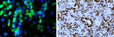 TUNEL assays | ABP Biosciences