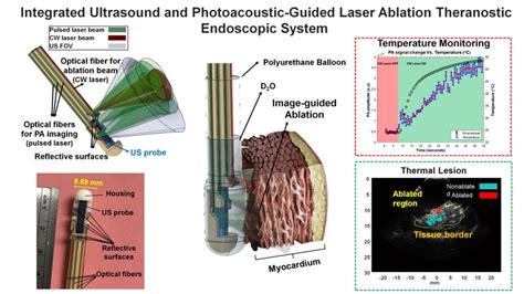 Integrated Ultrasound And Photoacoustic Guided Laser Ablation