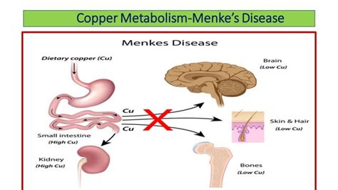 Copper Metabolism And Its Clinical Significance Ppt