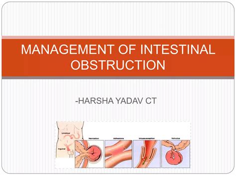 Acute Intestinal Obstruction Management Ppt