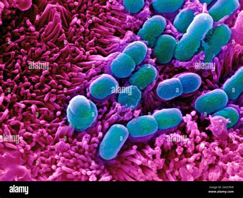 E Coli Bakterien Farbige Scanning Electron Micrograph Sem Von Escherichia Coli Bakterien