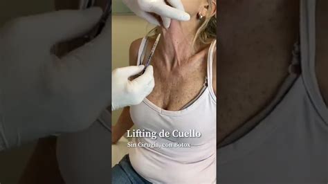 El Secreto Del Lifting De Cuello Sin Cirug A Valeth