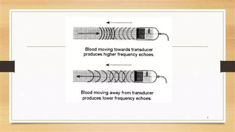 Doppler Effect - Ultrasound | PPT