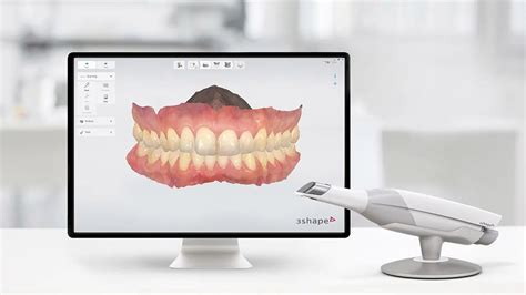 The Trios 3Shape Scanner Revolutionizing Dental Impressions