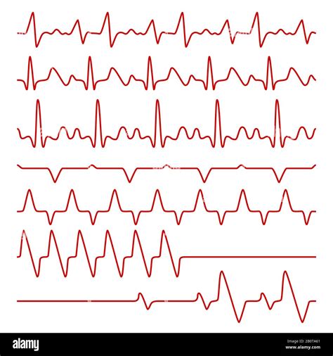 Electrocardiogramas Vectoriales De Línea O Electrocardiograma En Monitor Símbolos Médicos De