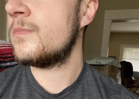 Beard Growth Advice Rftm