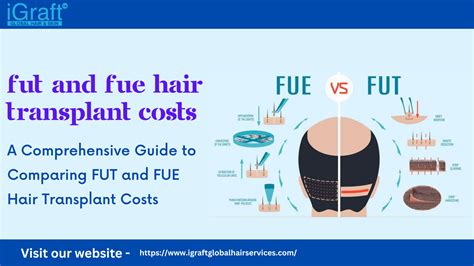 A Comprehensive Guide To Comparing Fut And Fue Hair Transplant Costs