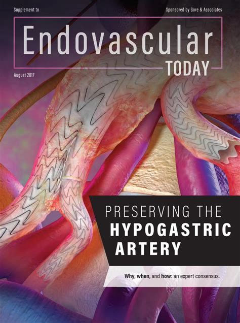 Pdf Preserving The Hypogastric Artery Dokumentips