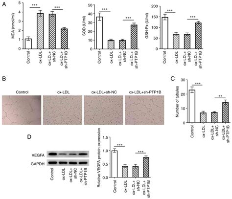 Ptp1b Inhibition Ameliorates Inflammatory Injury And Dysfunction In Ox