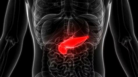 Pancreatitis qué es síntomas prevención y tratamiento