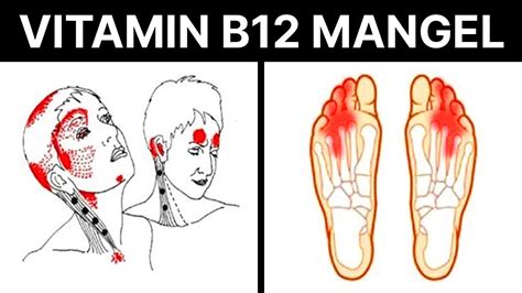 5 Anzeichen Eines Vitamin B12 Mangels Die Du Niemals Ignorieren