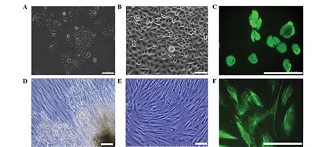 Co‑culture With Human Fetal Epidermal Keratinocytes Promotes