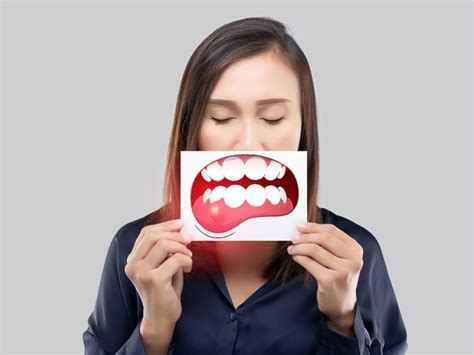 kanker mulut gejala penyebab pengobatan pencegahannya axa mandiri