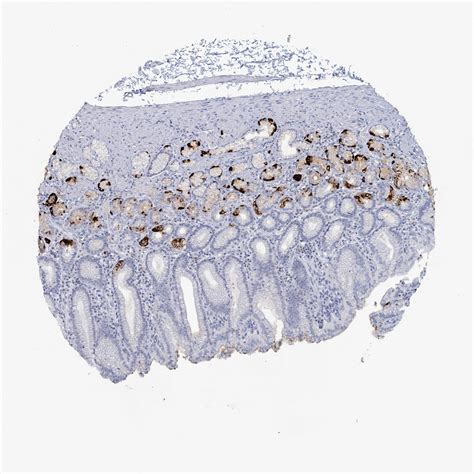 Tissue Expression Of Chga Staining In Stomach The Human Protein Atlas