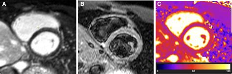 Frontiers Novel Role Of Cardiovascular MRI To Contextualise