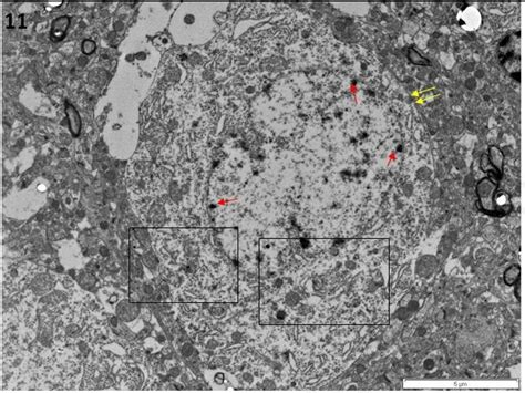 Zoom in Fig 8 showed nucleus membrane (yellow arrow head) was broken... | Download Scientific ...