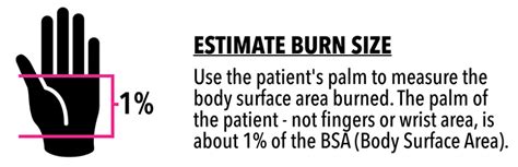 How To Determine The Body Surface Area Of A Burn Burnshield