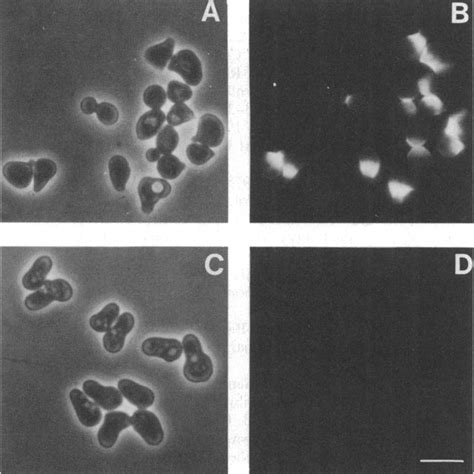 Fluorescence And Phase Contrast Micrographs Of Wildtype A And B And