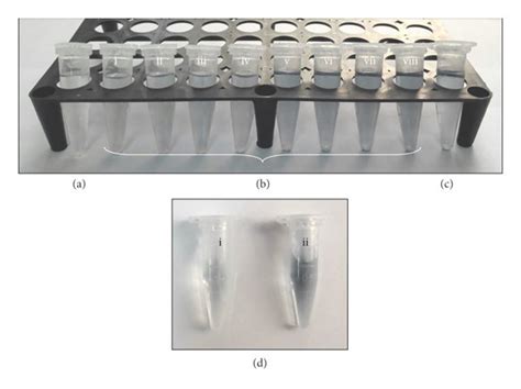 Bradford Vs Lowry Protein Concentration Gives Dramatic Off