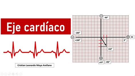 ELECTROCARDIOGRAMA Cómo calcular el eje cardíaco YouTube