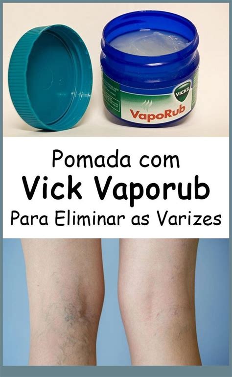 Pomada Vick Vaporub Para Eliminar Todas As Varizes C