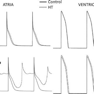 Human Atrial And Ventricular Action Potentials Ap Simulated In