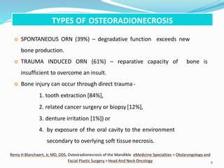 Osteoradionecrosis Pptx