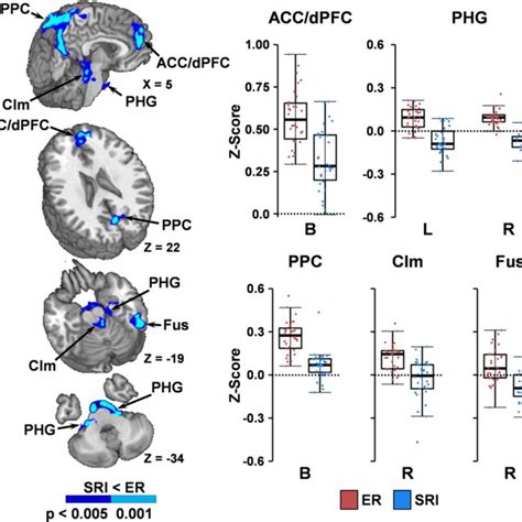 Connectivity To Anterior Cingulate Gyrus Brain Renderings Depict Areas