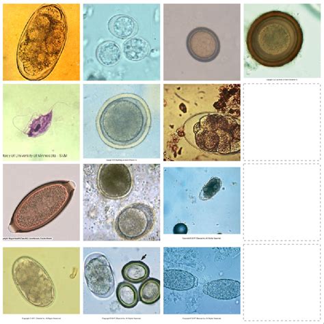 endoparasites part three Diagram | Quizlet