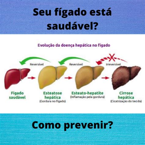 Inflamação Do Fígado Nome - A saúde de seu fígado - INONIZE