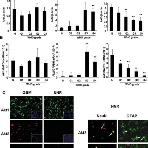 Protein And MRNA Expression Of Akt Isoforms In Glioma Cell Lines A