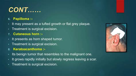 Tumors Of Ear Ppt Free Download