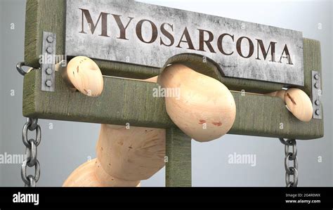 Myosarcoma hi-res stock photography and images - Alamy