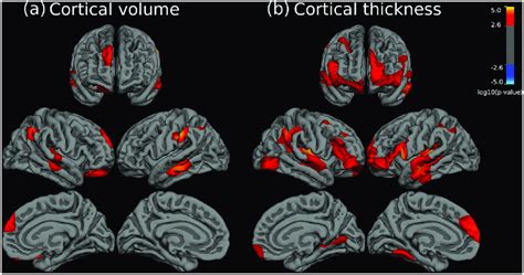 Brain Regions Showing Significant Statistical Differences Between