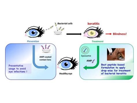 Esculentin 1a derived peptides for treatment of microbial keratitis ...