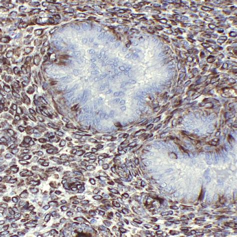 vimentin  pathnsitu biotechnologies