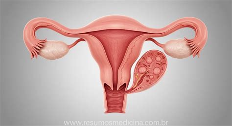 O Que Significa Amenorreia - Amenorreia: Guia Completo Sobre Causas, Tipos, Diagnóstico e Abordagem ...