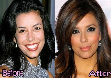 Eva Longoria Plastic Surgery Before After Photos