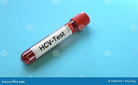 Hcv Virus Test Stock Illustration Illustration Of Medicine 143031559