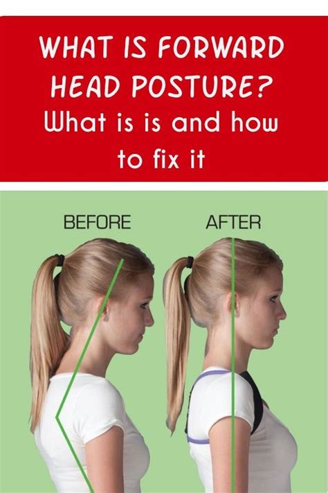 Forward Head Posture Symptoms How To Fix Your Neck Pain