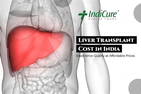 Liver Transplant In India Cost Hospitals And More By Indicure Health Tours Issuu