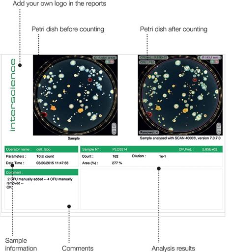 Scan Colony Counter Interscience