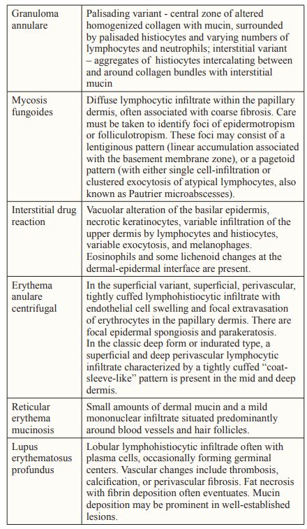 Fulltext Patch Type Granuloma Annulare A Therapeutic And Diagnostic