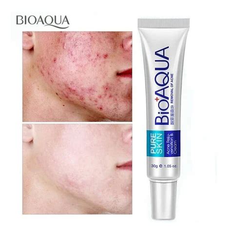 Crema Anti Acne Y Cicatrices Bioaqua