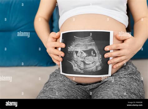 Echographie Abdomen Banque De Photographies Et Dimages à Haute