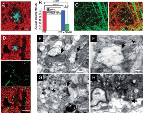 Axonal Swelling Is Intimately Associated With Structural Disruption Of